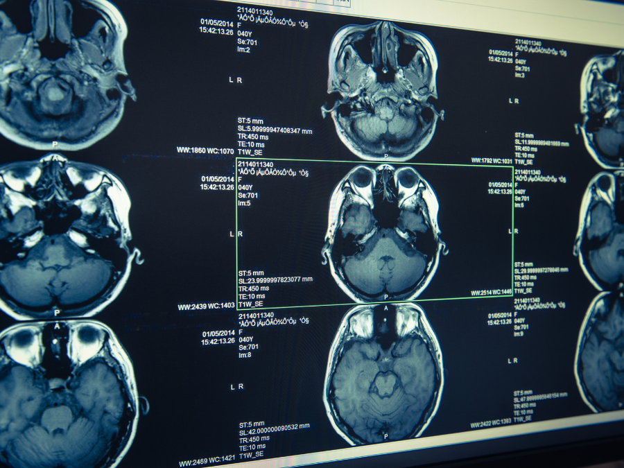 CT-scan 