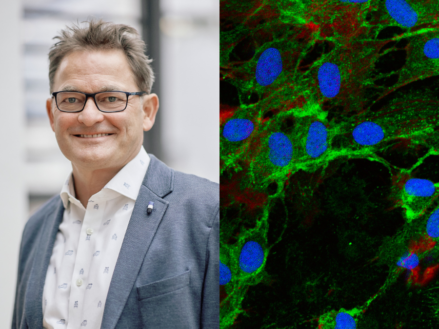 Unraveling the Potential of Stem Cells: From insights into Clonal Hematopoiesis, Acute Myeloid leukemia and Nerves in Pancreatic Cancer to Innovative Cancer Therapies