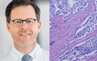 Advancing Pancreatic Surgery: Bridging Clinical Practice and Research