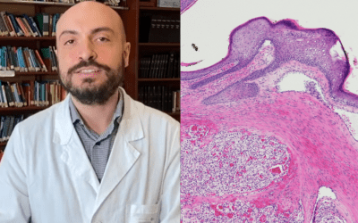 From omics to clinical decision-making: advancing precision medicine in head and neck oncology