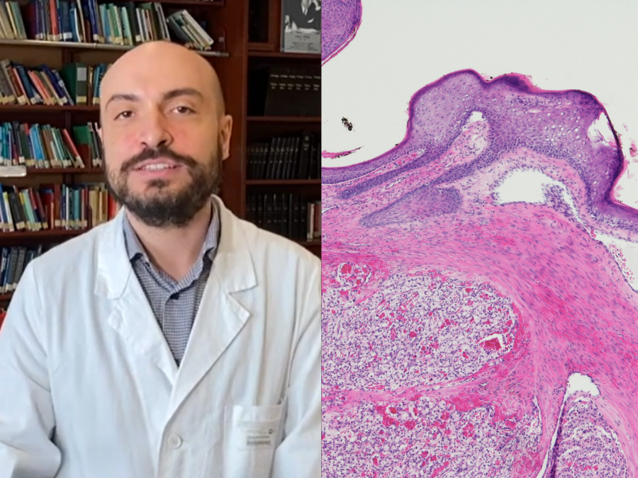 Stefano Cavalieri head and neck oncology